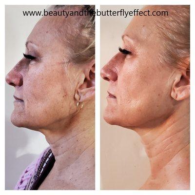 Beauty and Butterfly Effect