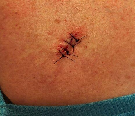 Don F King, MD - Preferred Dermatology