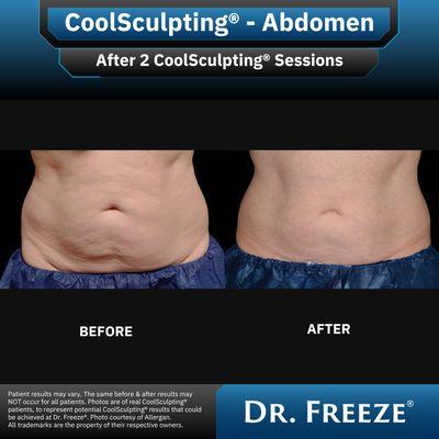 Dr. Sculpt CoolSculpting & EmSculpt Center