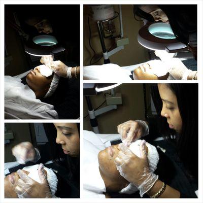 Performing Extractions