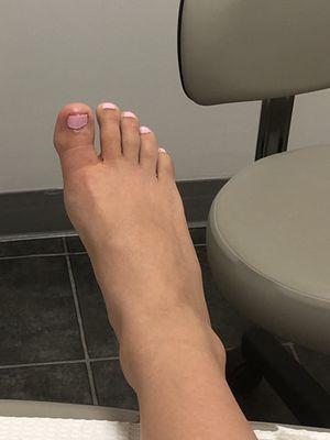 Homegirls toe has a heartbeat of its own at this point.