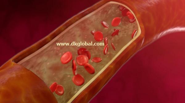 An Interactive Medical Illustration by DK Global Inc