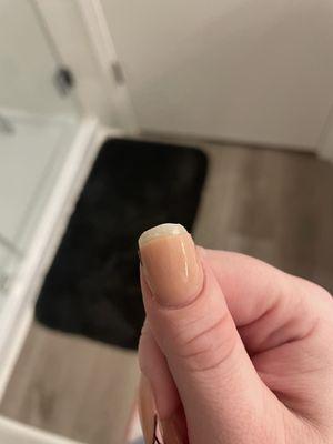 Broken thumb nail