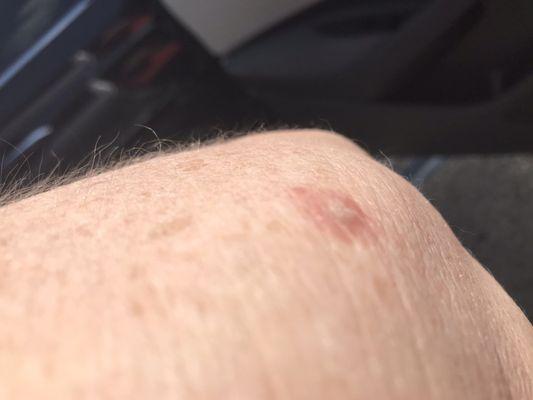 Legends Dermatology: Iulia Funieru, MD