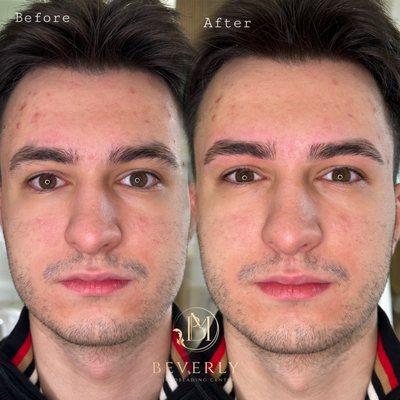 Beverly Microblading Center