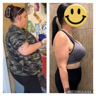 Epic Care Cyberknife