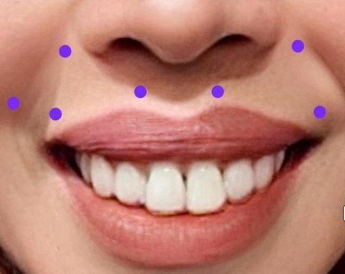 Olympia South Sound Oral Surgery