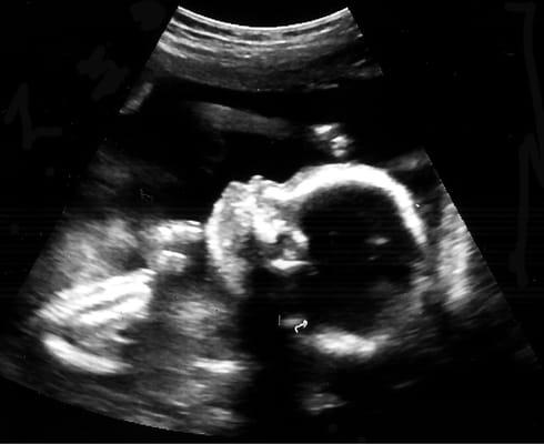 Triangle Imaging Solutions Inc.