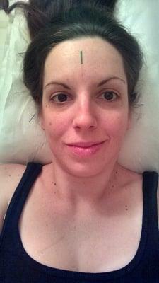 Solutions Acupuncture & Naturopathic Medicine