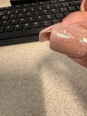 Again nail separation