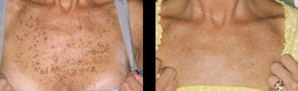 Premier Spa & Cosmetics