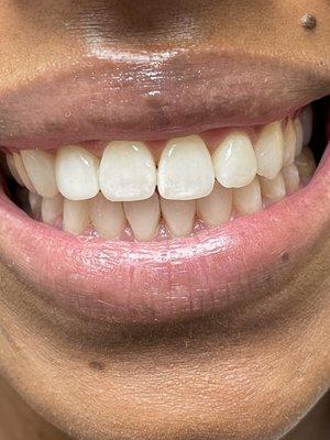 Tania Baker, DDS - Calabasas Dental Spa