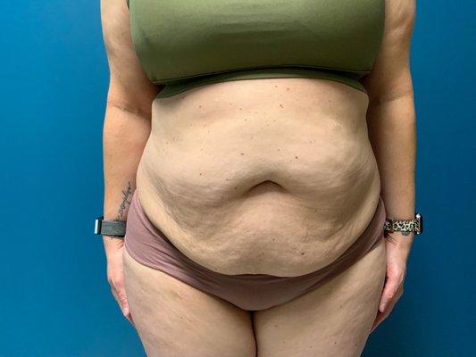 Precision Plastic Surgery