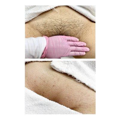 My very first Brazilian