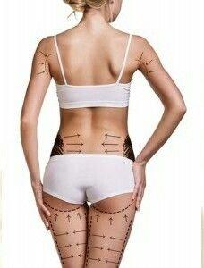 CoolSculpting, Emsculpt, Vaser Shape and SculpSure available for non-invasive body contouring at Trinity Medical Spa.