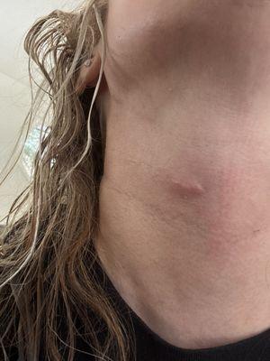 Crystal Coatney PA-C - Cal Derma