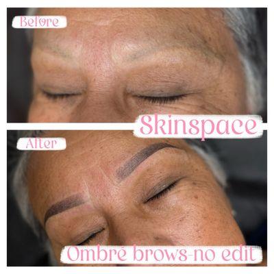 SkinSpace