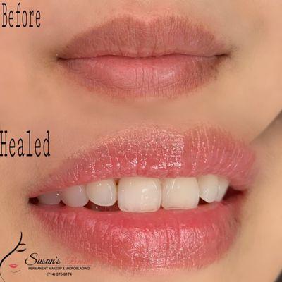 Brightening dark lip Healed result after 3months