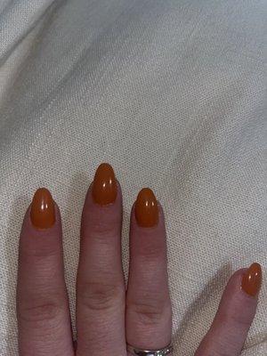 Flooded cuticles. I also asked for pointed nails and they're rounded.