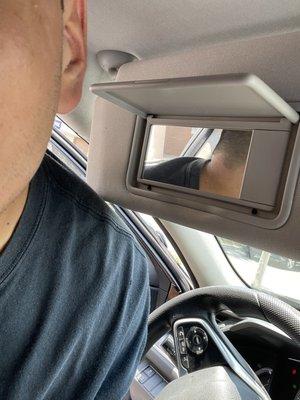 Fucked up hairline  got me looking crazy out here