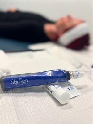 Microneedling patient with only the best microneedling device - SkinPen. Our patients deserve the best!