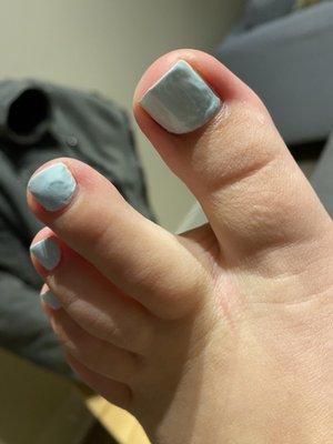 Pedicure - lumpy polish application