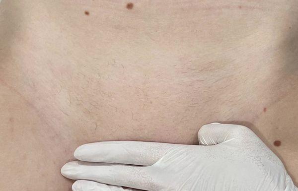 5 weeks of growth post Brazilian!