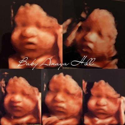 My baby girl's 5d Photos