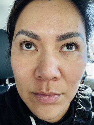 Brow Rehab