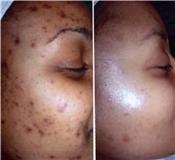 Beautiful Faces Skincare