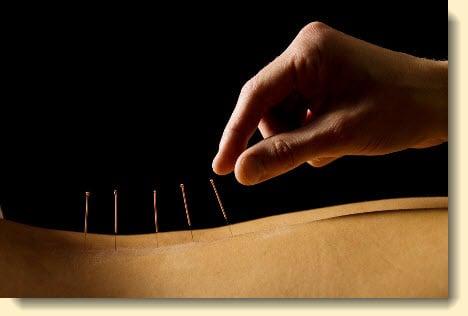 Linda McCray, L.Ac., HHP