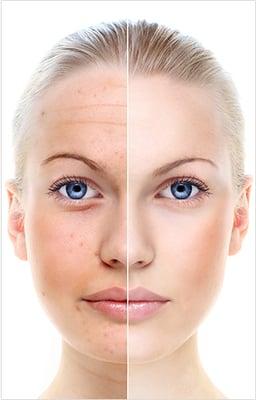 Corrective skin care