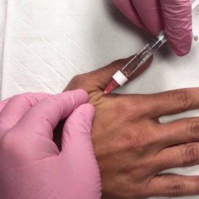 Smart Liposuction Center