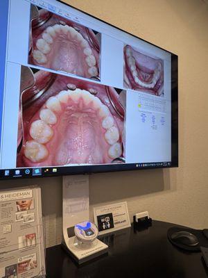 He explained everything that's going on with my teeth.