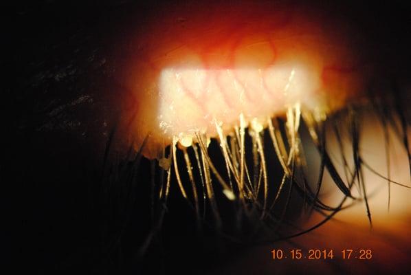 Colin R Bernstein, OD