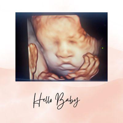 See your little bundle of joy in 3D/4D and HD Live.