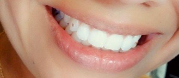 Matching sweet tooth fangs in pink Swarovski crystals