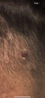 Clippers weren't properly cleaned, causing irritation and scabs. Also didn't give me the high taper I asked for