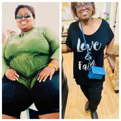 Valaria came in at 330 lbs and started our 100% natural Platinum Metabolic Program, achieving a healthy weight of 180 lbs.