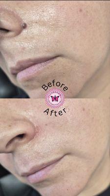 Plush Derma Laser Clinic