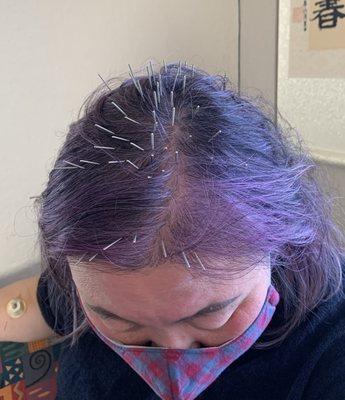 Joy Acupuncture Clinic