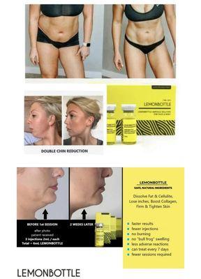 No need for surgery, general anaesthia and all that scary stuff! Try our needleless lipo shots today! That's right, no needles! No downtime!