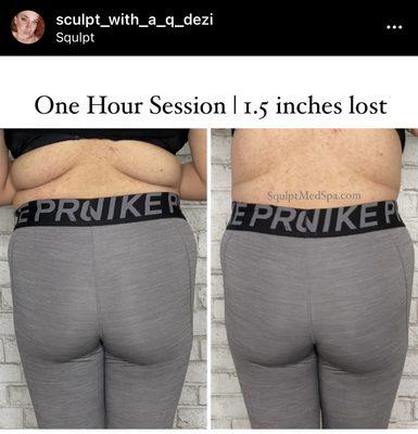 Clients first session, look at the change in her back.