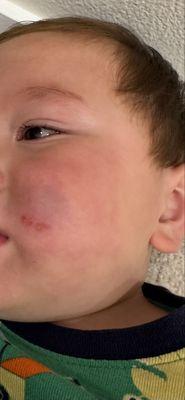 Wild Lilac Child Development Community