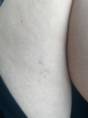 Apparently caused by scratching.....