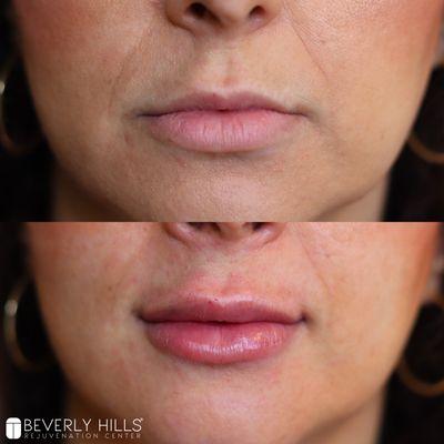 Beverly Hills Rejuvenation Center - West Hollywood, CA