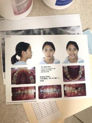 Prior to Dr. Shen's work