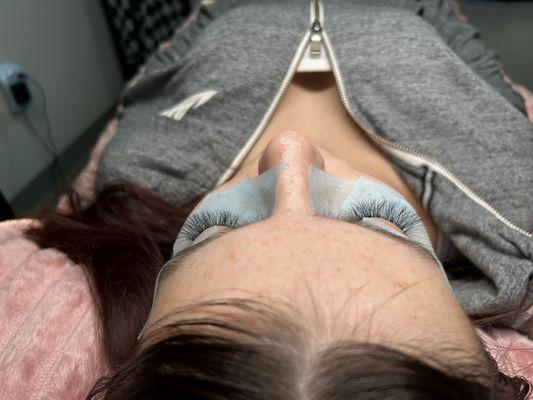 fill after 6 weeks! forgot to take a before pic!