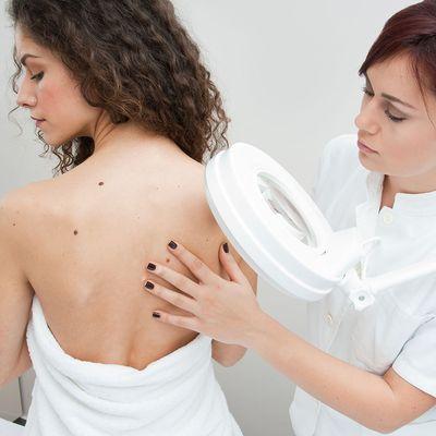 Skin Checks are vital to health