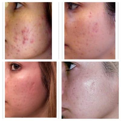 Eve & Adam Sugaring Studio